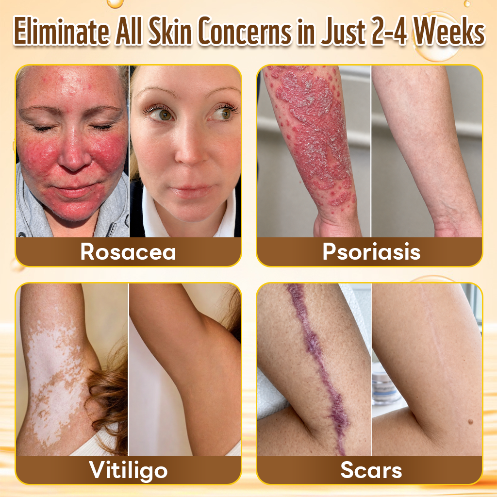 Extra 50% off! 𝑪𝒐𝒏𝒈𝒓𝒂𝒕𝒖𝒍𝒂𝒕𝒊𝒐𝒏𝒔! 𝒀𝒐𝒖’𝒓𝒆 𝒐𝒖𝒓 500𝒕𝒉 𝒄𝒖𝒔𝒕𝒐𝒎𝒆𝒓 𝒕𝒐𝒅𝒂𝒚, 𝒂𝒏𝒅 𝒚𝒐𝒖 𝒈𝒆𝒕 𝒕𝒐 𝒆𝒏𝒋𝒐𝒚 𝒂 𝒔𝒑𝒆𝒄𝒊𝒂𝒍 𝒐𝒇𝒇𝒆𝒓: 𝒂 𝒔𝒆𝒄𝒐𝒏𝒅 𝒑𝒓𝒐𝒅𝒖𝒄𝒕 𝒇𝒐𝒓 50% 𝒐𝒇𝒇! HISKIN®