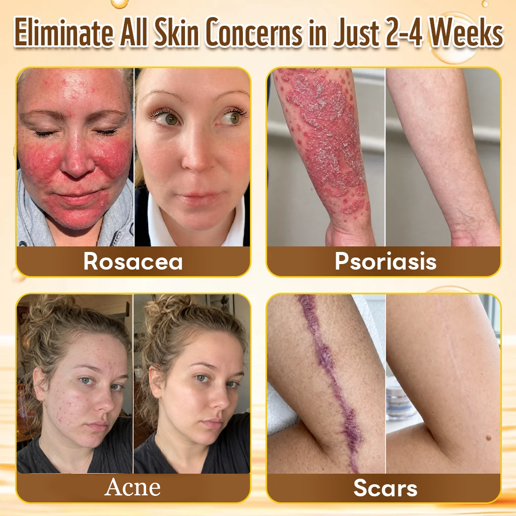 ✨HISKIN® Multi-Concern Skin Repair Cream (One powerful cream to repair inflammation, dryness, aging, pigmentation, and visible skin damage.)