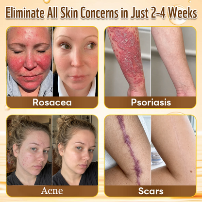 ✨HISKIN® Multi-Concern Skin Repair Cream (One powerful cream to repair inflammation, dryness, aging, pigmentation, and visible skin damage.)